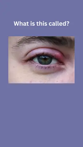 A post by @247.english.station on TikTok caption: Can you guess these common skin problems_ #learnenglish #dailyenglish #vocabulary #learn #fyp #fypシ #TikTok #Viral #foryou #foryoupage #TiKTOKVIRAL#teacher #inglesonline #learnenglishonline #easyenglish #englishwords #englishspeaking #speakingenglish #vocab #englishidiomss #wordofthedaye #cursodeingles #dicasdeingles #speaking #study #learningisfun #englishisfun #spokenenglish #languagelearning #pronunciation #teachingenglish #learninglanguages #bhfyp #englishlearners #inglese #phrasalverbs #ieltspreparation #learningenglishonline #englishforkids #grammar #englishgrammar #fyp #fypシ #TikTok #Viral #foryou #foryoupage #TiKTOKVIRAL#teacher #inglesonline #learnenglishonline #easyenglish #englishwords #englishspeaking #speakingenglish #vocab #englishidiomss #wordofthedaye #cursodeingles #dicasdeingles #speaking #study #learningisfun #englishisfun #spokenenglish #languagelearning #pronunciation #teachingenglish #learninglanguages #bhfyp #englishlearners #inglese #phrasalverbs #ieltspreparation #learningenglishonline #englishforkids #grammar #englishgrammar