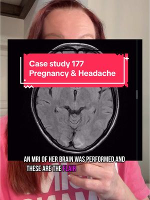 A post by @ladyspinedoc on TikTok caption: 𝐂𝐚𝐬𝐞 𝐬𝐭𝐮𝐝𝐲 177 - ⁣ headache and pregnancy ⁣ ⁣⁣⁣ A 27-year-old G1P0 woman arrives to the emergency department 34 weeks pregnant with acute onset of headache with progressive vision loss. She suffered a seizure in route via EMS. Her presentation is in the video and MRI brain is shown. What is the diagnosis? what is the treatment? Stay tuned tomorrow and I’ll explain the whole case. ⁣⁣⁣ ⁣⁣⁣ #𝘴𝘶𝘯𝘥𝘢𝘺𝘤𝘢𝘴𝘦𝘴𝘵𝘶𝘥𝘺  #𝘭𝘢𝘥𝘺𝘴𝘱𝘪𝘯𝘦𝘥𝘰𝘤⁣⁣⁣⁣⁣⁣⁣⁣⁣⁣⁣⁣⁣⁣⁣⁣⁣⁣⁣⁣⁣⁣⁣⁣⁣⁣ #𝘩𝘦𝘢𝘭𝘵𝘩𝘤𝘢𝘳𝘦𝘸𝘰𝘳𝘬𝘦𝘳 #𝘩𝘰𝘴𝘱𝘪𝘵𝘢𝘭 #𝘴𝘶𝘳𝘨𝘦𝘳𝘺 #𝘯𝘦𝘶𝘳𝘰𝘴𝘶𝘳𝘨𝘦𝘰𝘯 #𝘮𝘦𝘥𝘪𝘤𝘢𝘭𝘴𝘤𝘩𝘰𝘰𝘭 #𝘮𝘦𝘥𝘴𝘵𝘶𝘥𝘦𝘯𝘵 #𝘮𝘦𝘥𝘪𝘤𝘢𝘭𝘴𝘵𝘶𝘥𝘦𝘯𝘵 #𝘯𝘶𝘳𝘴𝘪𝘯𝘨