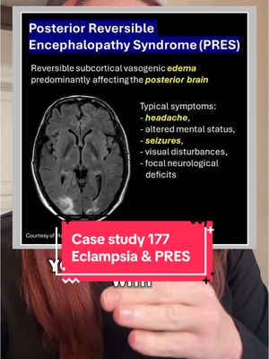 A post by @ladyspinedoc on TikTok caption: Replying to @Daisy Mae Case Study 177 - Eclampsia and Posterior Reversible Encephalopathy syndrome (PRES)  ⁣⁣⁣⁣ Eclampsia can lead to serious neurological complications, including Posterior Reversible Encephalopathy Syndrome (PRES)—a condition characterized by seizures, visual disturbances, and altered mental status. This case study highlights the importance of early recognition, BP management, and neuroimaging to prevent long-term deficits. Timely intervention often leads to full recovery. #Eclampsia #PRES #MedicalEducation #Neurology #ObGyn #HypertensiveEncephalopathy #Neuroimaging #CaseBasedLearning #ClinicalPearls #ResidentEducation #BrainHealth #MaternalCare #𝘴𝘶𝘯𝘥𝘢𝘺𝘤𝘢𝘴𝘦𝘴𝘵𝘶𝘥𝘺  #𝘭𝘢𝘥𝘺𝘴𝘱𝘪𝘯𝘦𝘥𝘰𝘤⁣⁣⁣⁣⁣⁣⁣⁣⁣⁣⁣⁣⁣⁣⁣⁣⁣⁣⁣⁣⁣⁣⁣⁣⁣⁣⁣⁣ #𝘩𝘦𝘢𝘭𝘵𝘩𝘤𝘢𝘳𝘦𝘸𝘰𝘳𝘬𝘦𝘳 #𝘩𝘰𝘴𝘱𝘪𝘵𝘢𝘭 #𝘴𝘶𝘳𝘨𝘦𝘳𝘺 #𝘯𝘦𝘶𝘳𝘰𝘴𝘶𝘳𝘨𝘦𝘰𝘯 #𝘮𝘦𝘥𝘪𝘤𝘢𝘭𝘴𝘤𝘩𝘰𝘰𝘭 #𝘮𝘦𝘥𝘴𝘵𝘶𝘥𝘦𝘯𝘵 #𝘮𝘦𝘥𝘪𝘤𝘢𝘭𝘴𝘵𝘶𝘥𝘦𝘯𝘵 #𝘯𝘶𝘳𝘴𝘪𝘯𝘨⁣⁣⁣⁣⁣ #𝘣𝘳𝘢𝘪𝘯 