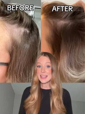 A post by @abbeyyung on TikTok caption: #NioxinPartner If you’ve been following me for the last couple years you already know that the @Nioxin Hair Fall Defense Serum is a top recommendation of mine for this product category. Not only because of the impressive technology, but also because of the impressive results it gave my sister in law! So it was like fate that my mom sent me a text about the amazing results she was experiencing with the new shampoo Nioxin launched in this collection- the Hair Fall Defense Shampoo. I don’t promote many products in this category because it’s one with a lot of gimmicks but I fully believe in the Nioxin Hair Fall Defense Technology! 🤍 