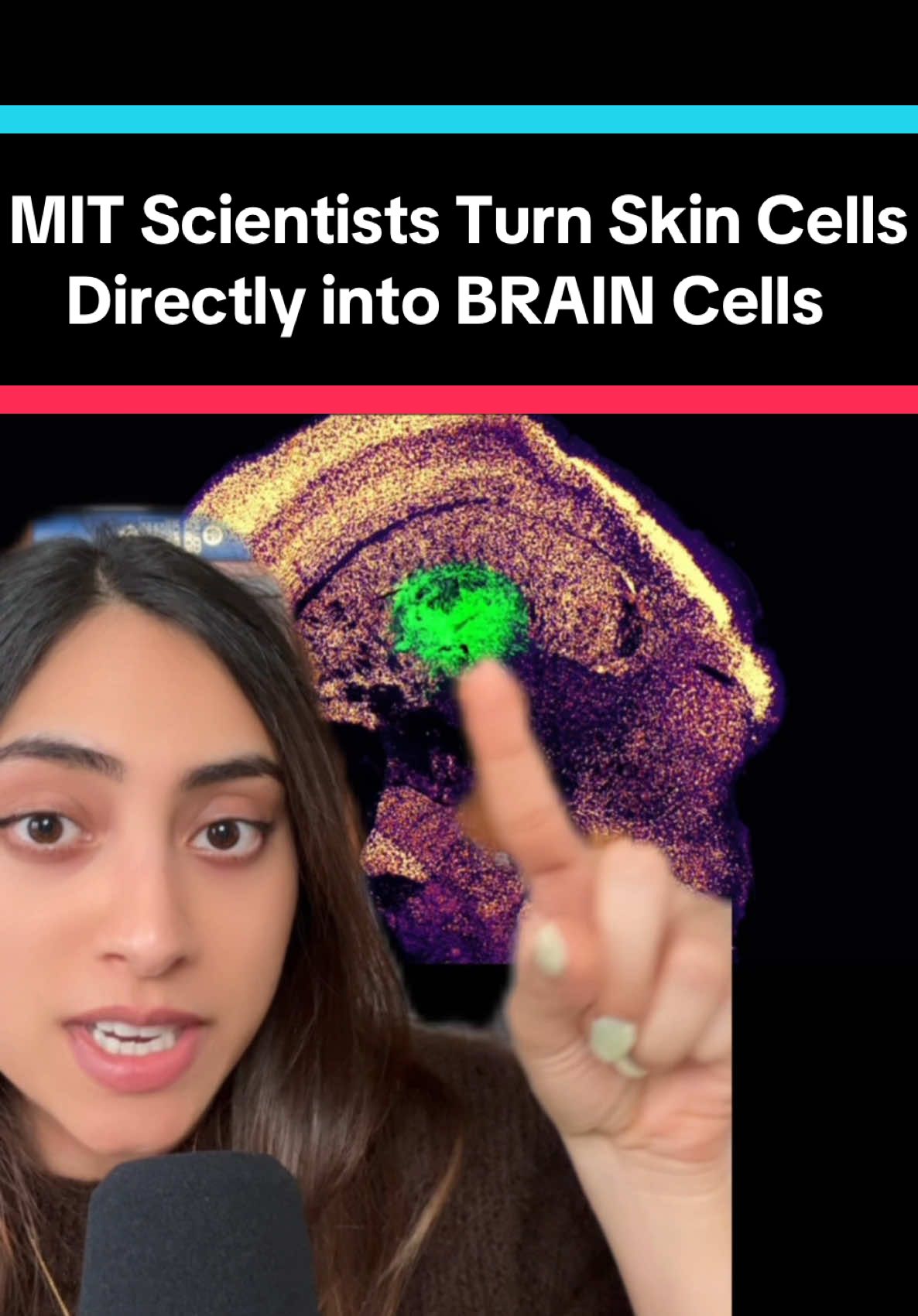 A post by @tilscience on TikTok caption: Science is so wild. MIT scientists figured out how to turn skin cells directly into BRAIN cells 🤯 Study: MIT engineers turn skin cells directly into neurons for cell therapy (MIT News) study linked in the article  #mindblown #science #edutok #stemcells #medicine 