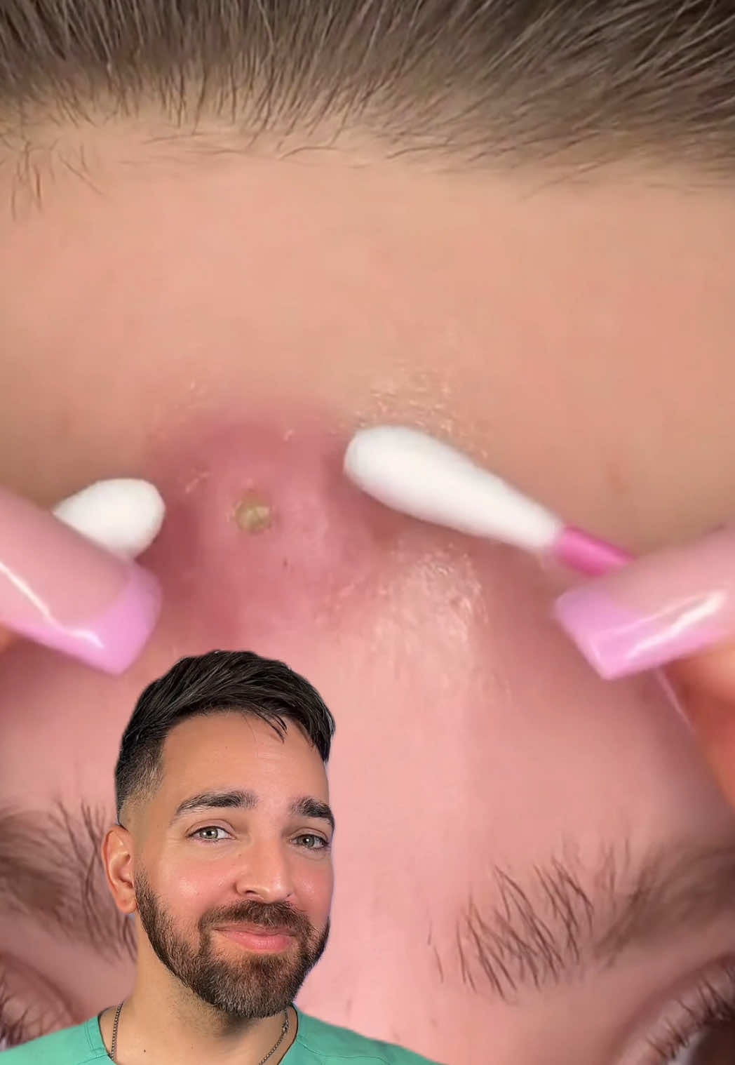 A post by @dermdoctor on TikTok caption: INSAANNNNNEEEE @cheeto🙈 