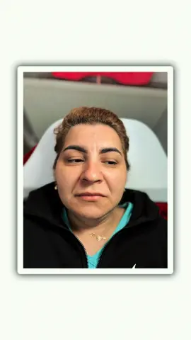 A post by @beautyelixiraf on TikTok caption: ##RusianLipss ##RusianLipss ##hyaluronpen ##hyaluronpen ##lips ##lips ##lips ##lips ##foryooupage #foryooupage #Craiova #Craiova ##Craiova ##ViralVideo ##ViralVideo ##hyaluronpen ##hyaluronpen ##Eloquence ##Eloquence 