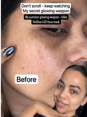 A post by @kripapateljoshi on TikTok caption: Link in bio — use my code KRIPA for $100 off + free $80 hydrating face masks! Want glowing skin without the salon bills? Meet Ulike ReGlow — my at-home LED therapy that actually works. This started as a PR gift, but let’s be real — I’d only talk about it if it showed results. Always pick what works for you, but this one made the cut.   @Ulike Beauty #redlighttherapy #ledmaskreview #ulikereglow