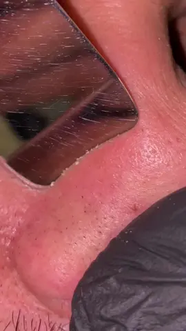 A post by @mahmoudgamalsalons on TikTok caption: New videos will be on my new account @Mahmoudgamaltrend  #trend_barbershop #تنضيف_بشرة #SkinCare #رؤوس_سوداء 