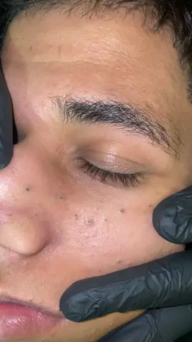 A post by @mahmoudgamalsalons on TikTok caption: Full video (17min)link in bio ❤️  #trend_barbershop #تنضيف_بشرة #SkinCare #رؤوس_سوداء @Mahmoudgamaltrend 