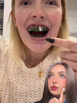 A post by @nouhailaait__ on TikTok caption: Whitening theeth strips