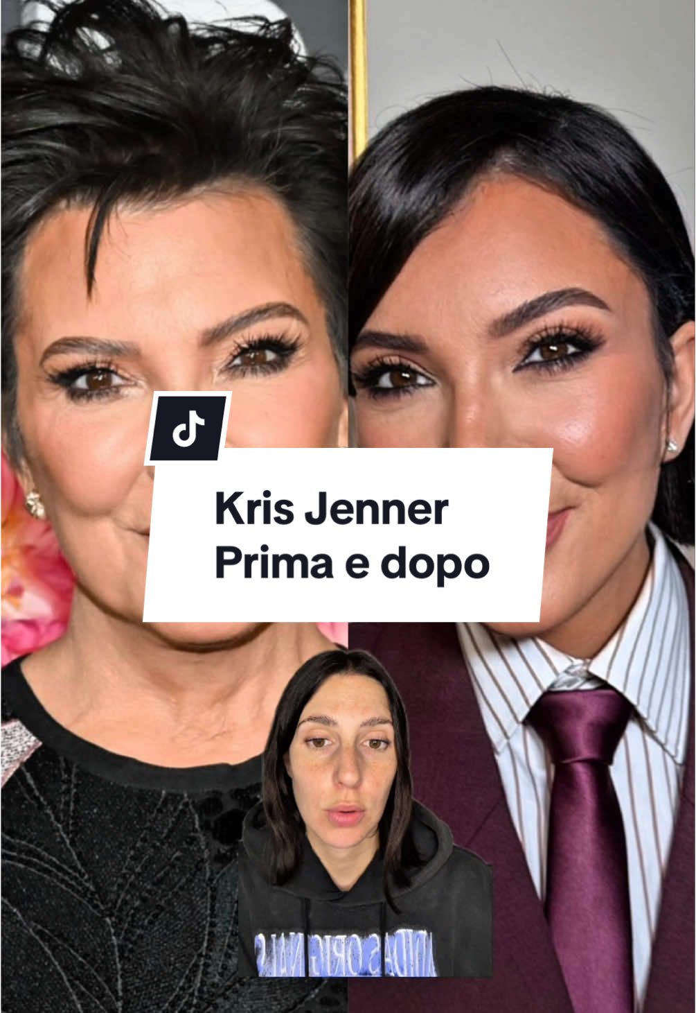 A post by @youaremylemonade on TikTok caption: Prima e dopo di Kris Jenner, 69 anni. Aveva dichiarato di aver fatto un lifting nel 2011 ma secondo me questo è il terzo. Comunque risultato incredibile 