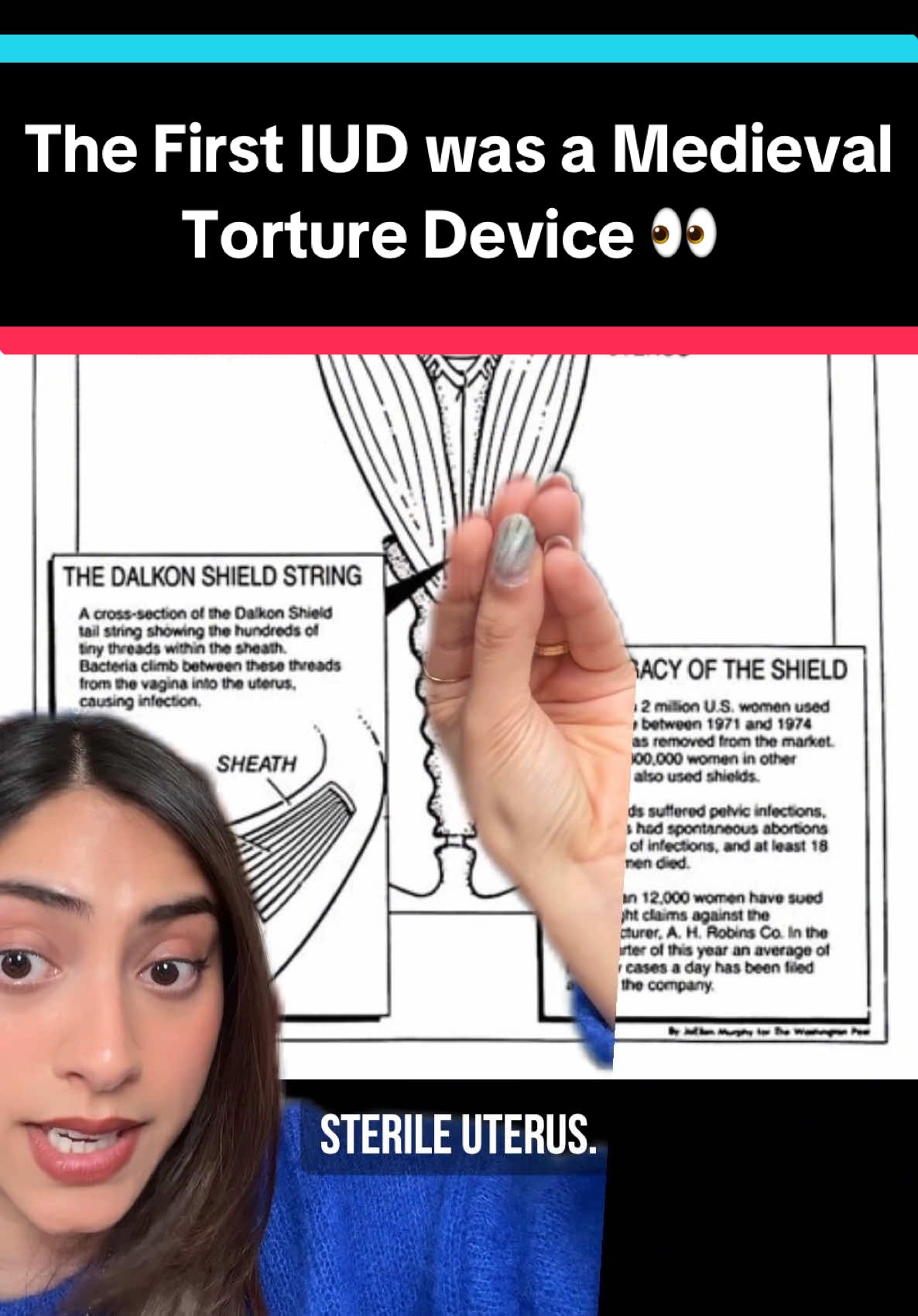 A post by @tilscience on TikTok caption: The first commercially available IUD straight up was a medieval torture device 👀  #science #medicine #didyouknow #birthcontrol 