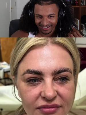 A post by @tettrembr on TikTok caption: isso não é real ib: @toucheclinicspb #eusoutet