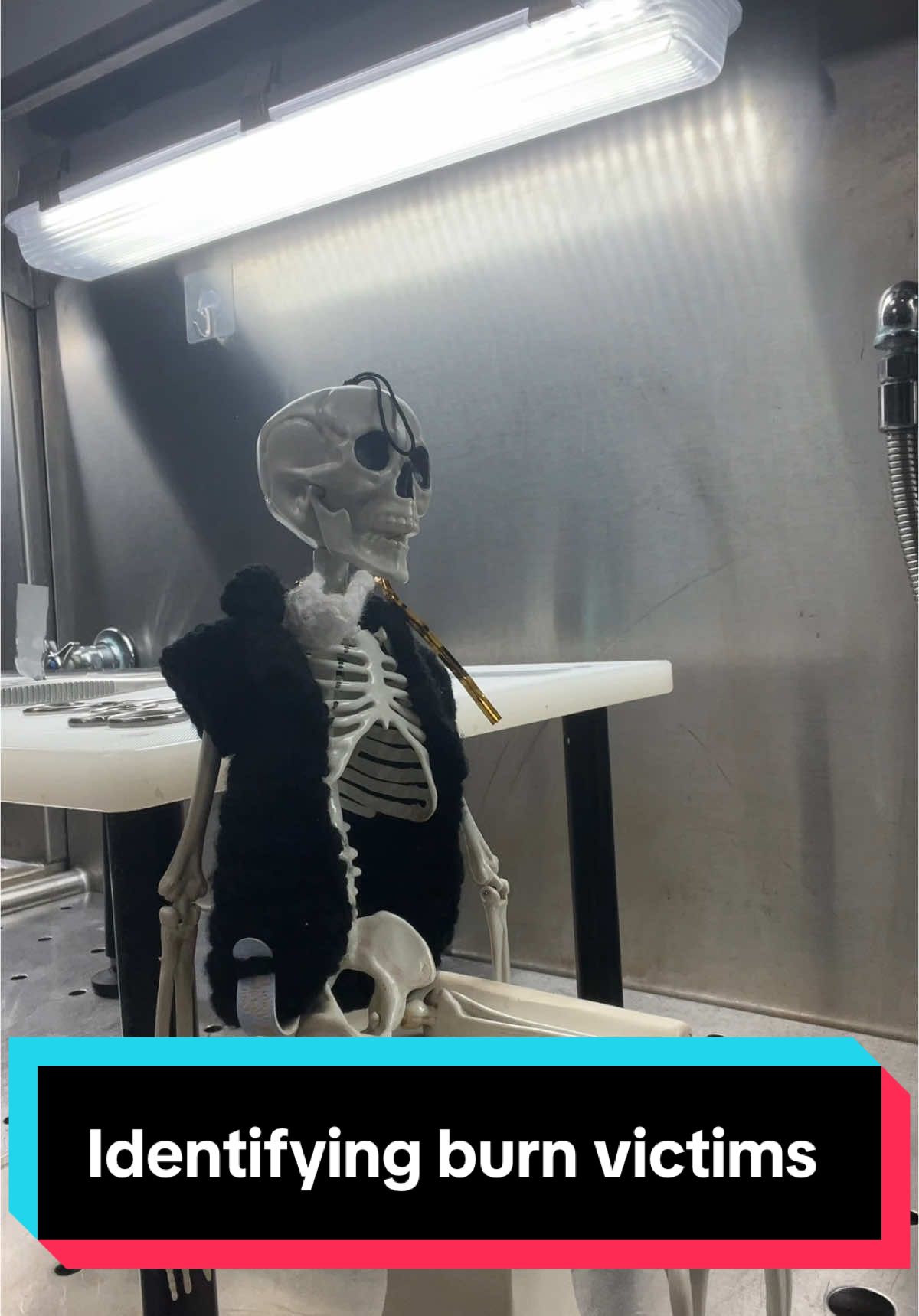 A post by @mortuivivosdocent127 on TikTok caption: Replying to @cleopatra.ngwenya a couple different ways to ID people who are no longer recognizable. We can take DNA from bones in the ribs or kneecaps. Everyone still gets dignity and respect In our care, regardless of how they look. #death #learnontiktok #autopsy #autopsytech #paramedic #forensics #burn #fyp #foryoupage 