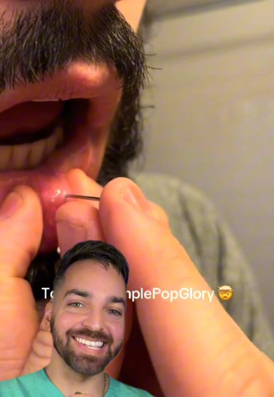 A post by @dermdoctor on TikTok caption: Rate this #mucocele 