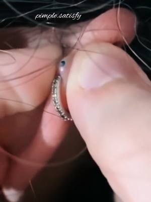 A post by @pimple.satisfy on TikTok caption: #cejour-là #explore #foryou 
