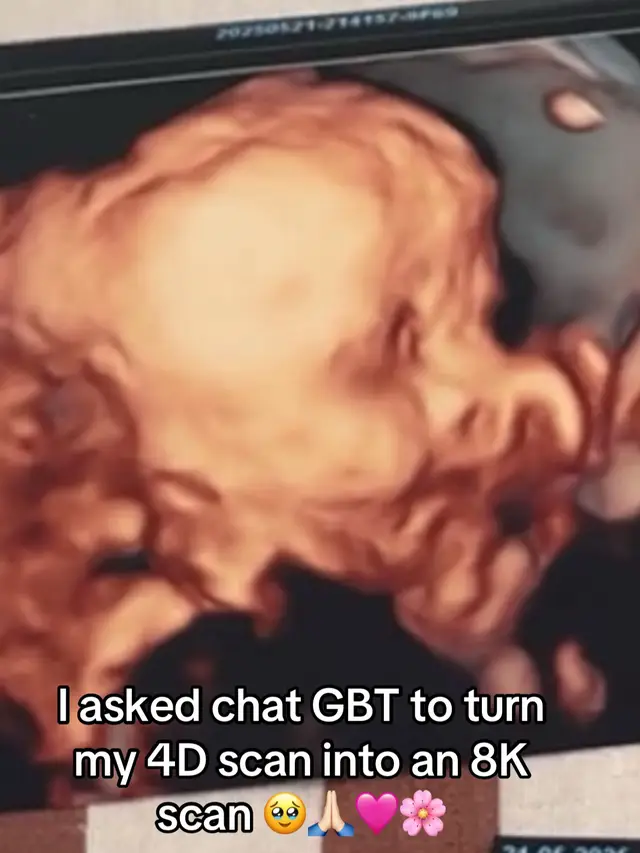 A post by @sakira_anays89 on TikTok caption: #videoviral #fyp #tiktokviral #babyscan #4dscan #8kscan #chatgpt #mybabygirl #🥹🥹 @Fabritio_fbx 