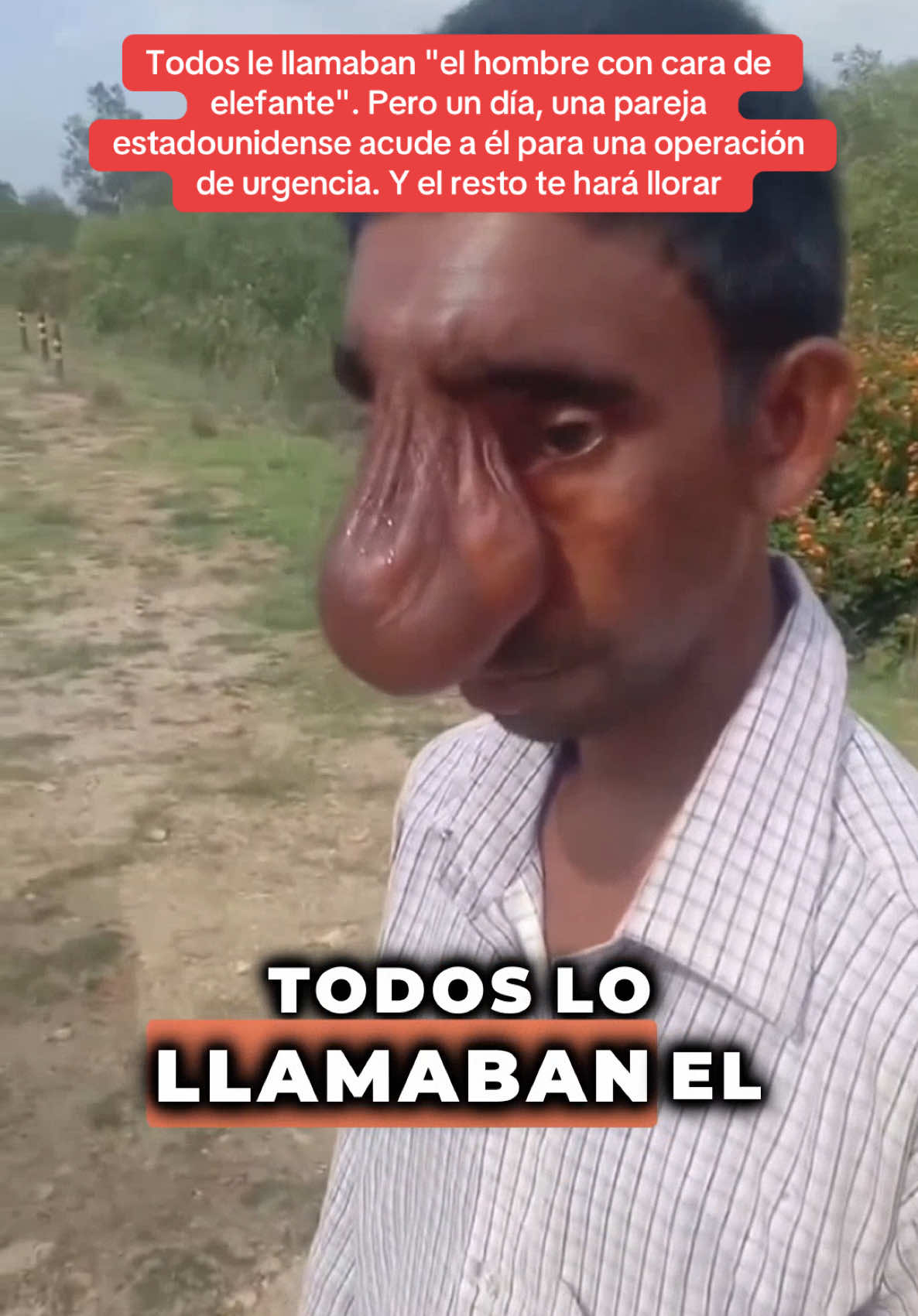 A post by @historia_real_estr on TikTok caption: todos le llamaban "el hombre con cara de elefante". Pero un día, una pareja estadounidense acude a él para una operación de urgencia. Y el resto te hará llorar. #sorprendente #historiasimpactantes #Sorpresa #misterio 