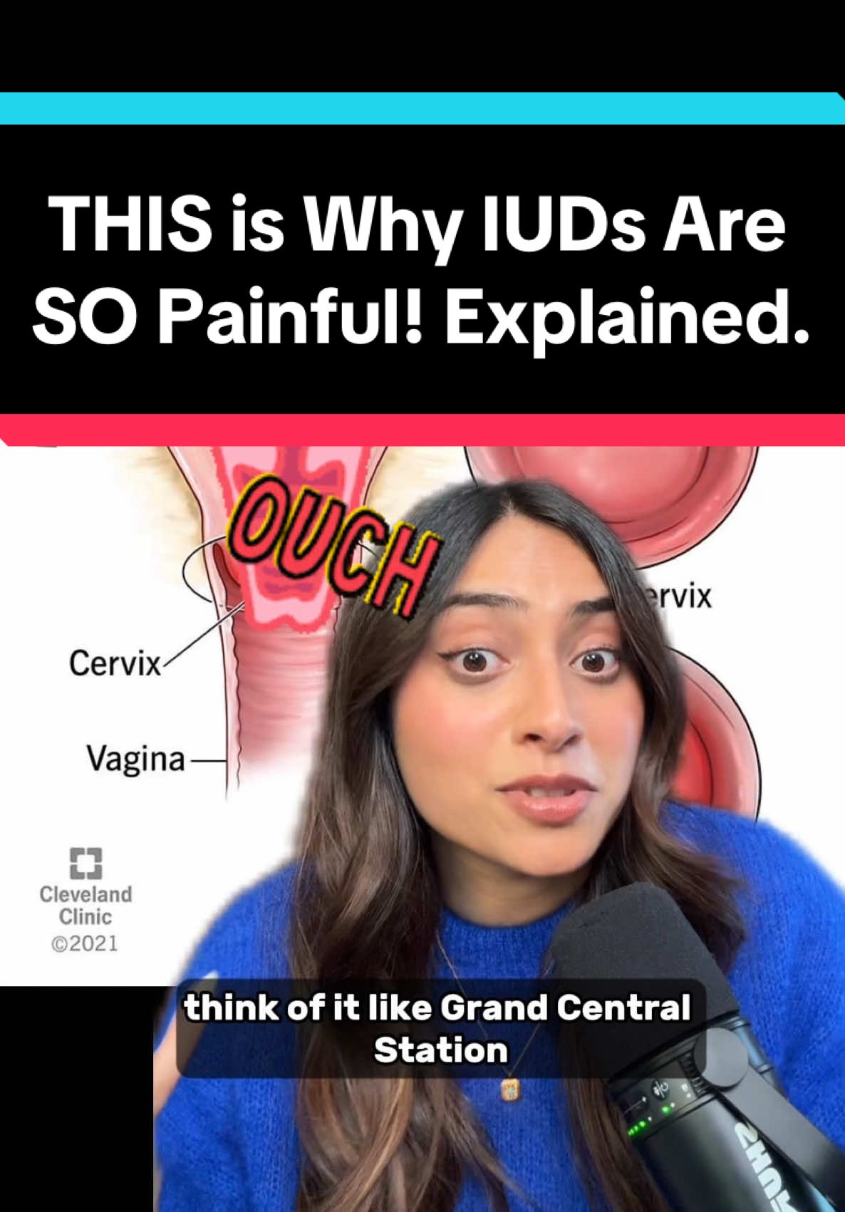 A post by @tilscience on TikTok caption: THIS is why IUDs are so dang painful. The pain is NOT in your head, it’s in your nerves - and not just one set of nerves but THREE.  In fact, your cervix sits at a junction where 3 major nerve pathways converge - making it one of the most neurologically sensitive areas in the entire body.  If you’ve had a “memorable” IUD experinence let me know 👇  We’re dropping a new YT video on Thursday all about this so make sure you’re subscribed! Ladies you will not want to miss this! #iud #birthcontrol #medicine #womenshealth #pain 
