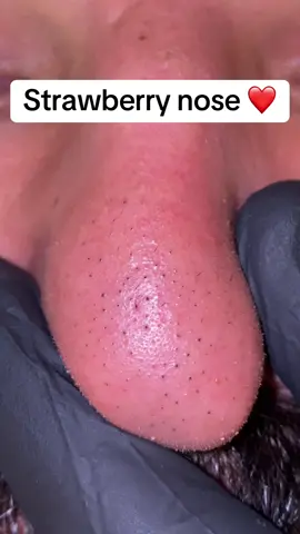 A post by @mahmoudgamalsalons on TikTok caption: Link in bio ❤️  #trend_barbershop #تنضيف_بشرة #SkinCare #رؤوس_سوداء 