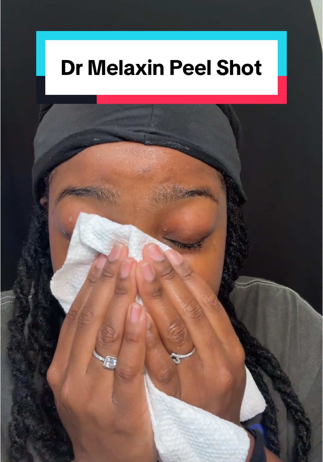 A post by @shoplikedes on TikTok caption: If you’ve been struggling with a way to remove those stubborn black heads… here’s your solution. Nobody doing it like Korean beauty  #drmelaxin #skinexfoliating #skincare #peelshotglow #exfoliation #tiktokshoprestock 