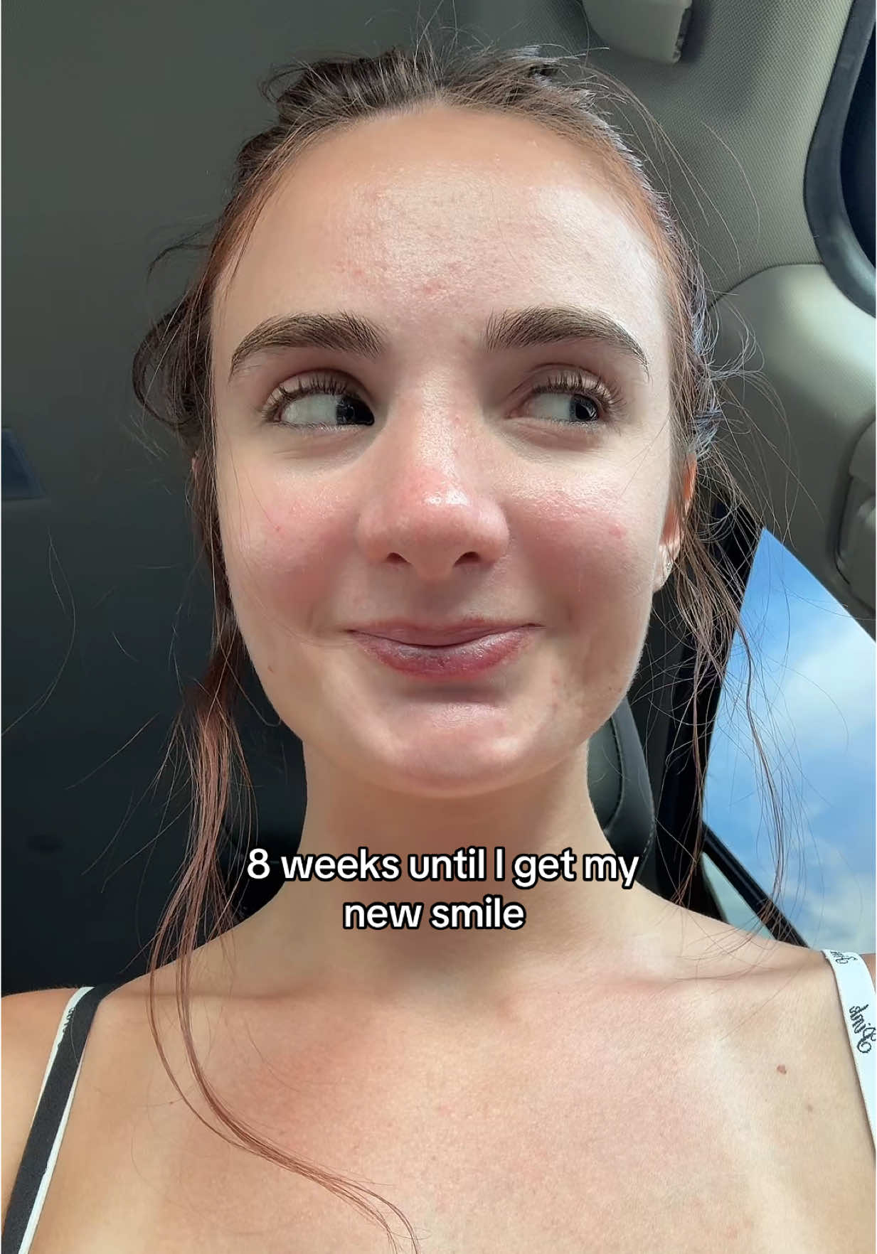 A post by @lexiorlove on TikTok caption: I show my smile at the end @OPNWYD_DMD #newsmile #smilemakeover #wendyortiz 