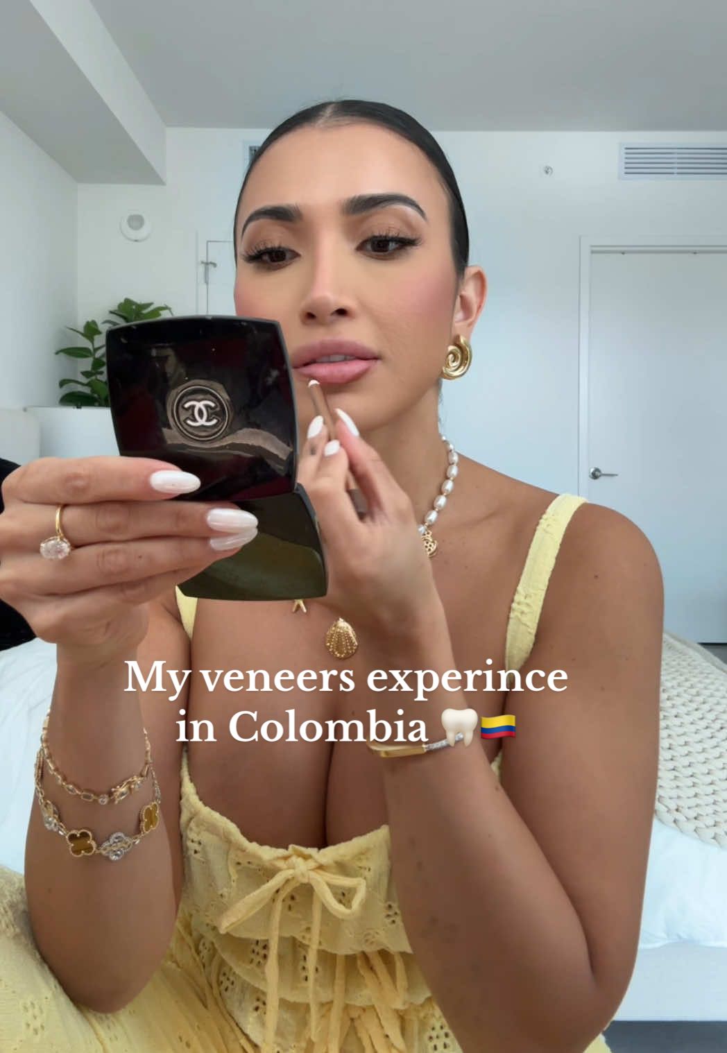 A post by @alexbravoxo on TikTok caption: Let’s talk details about my veneers experience in Medellín Colombia. @Alexox0 @Porcelain Veneers Colombia  #fyp #explorepage #grwm #veneers #veneersjourney #veneerscheck #porcelainveneers #colombiaveneers #perfectsmileexperience 