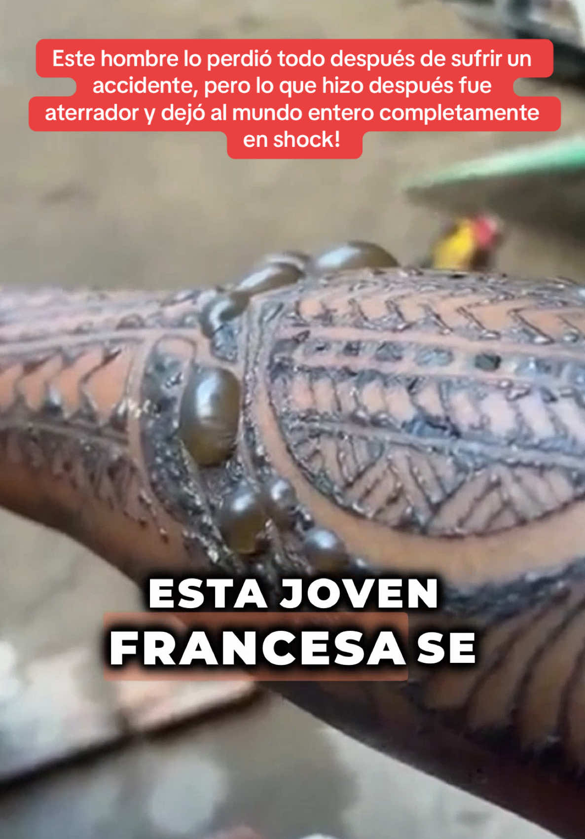 A post by @historia_real_estr on TikTok caption: Este hombre lo perdió todo después de sufrir un accidente, pero lo que hizo después fue aterrador y dejó al mundo entero completamente en shock! #historiasimpactantes #sorprendente #misterio #Sorpresa 