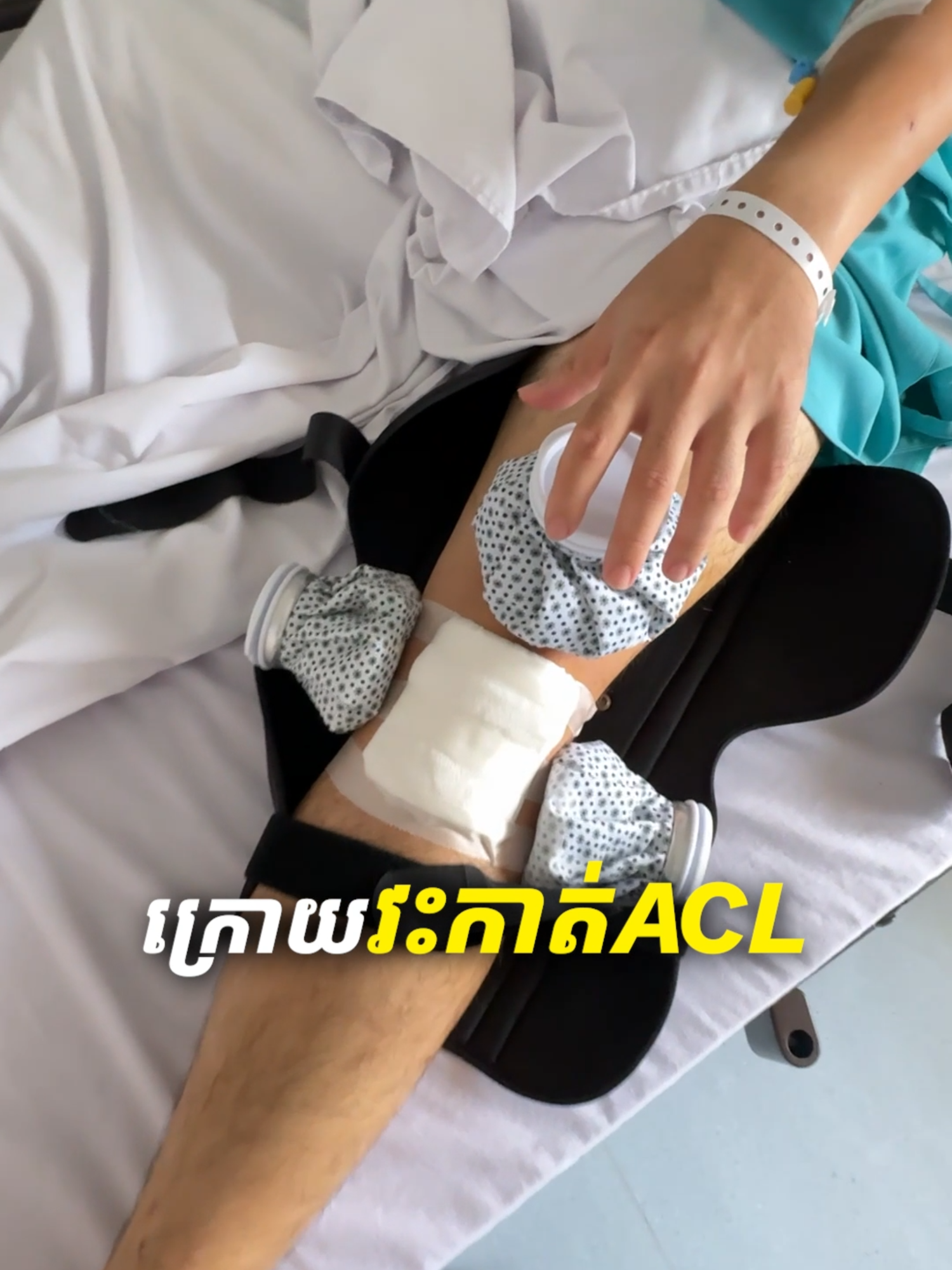 A post by @itsmelinson on TikTok caption: អ្វីដែលគួរនិងមិនគួរធ្វើ់ក្រោយវះកាត់ ACL ហើយ #khemra #acl #aclrehab #rehab #rehabilitation