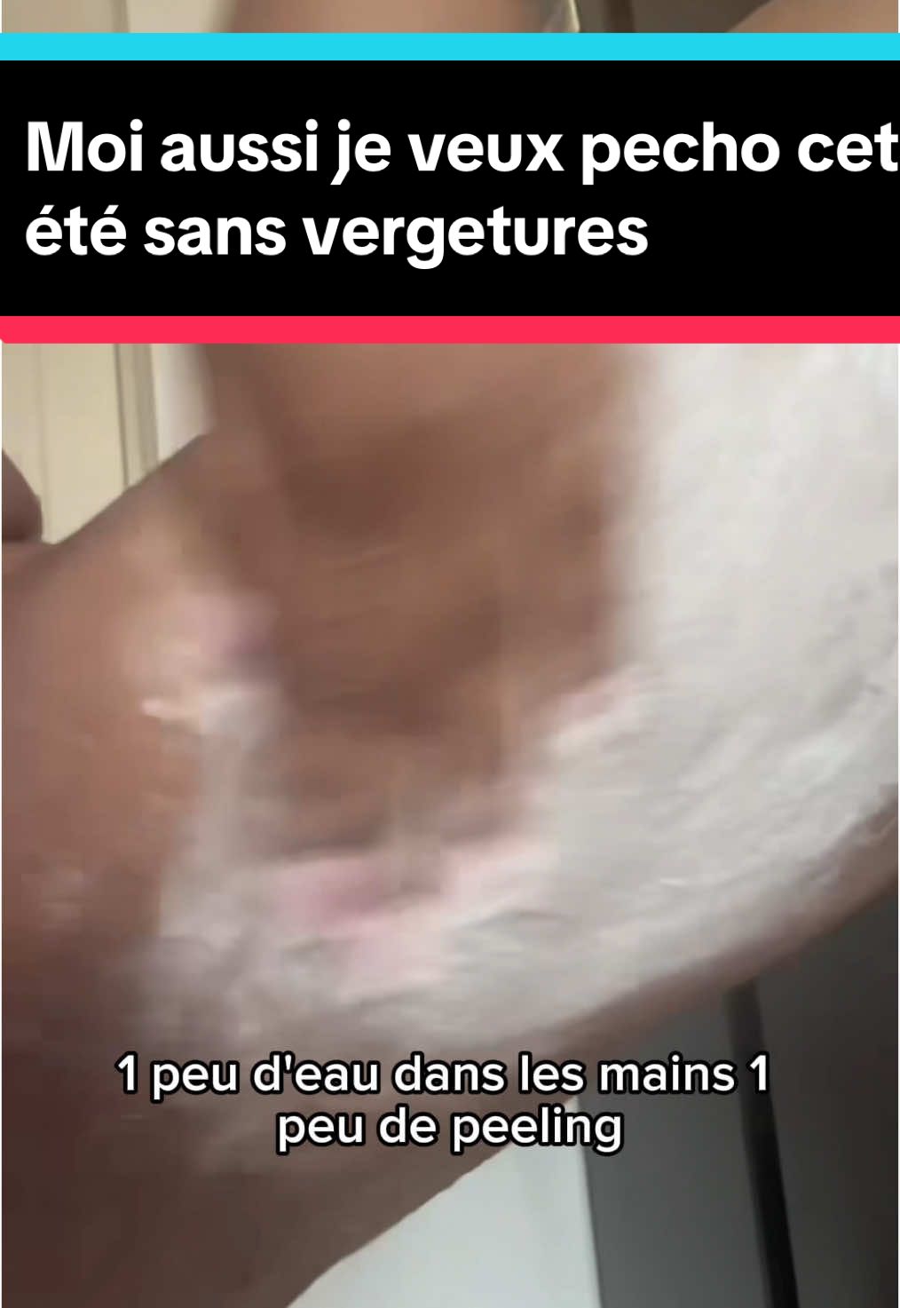 A post by @dialuskinfr on TikTok caption: Moi aussi je veux pecho cet été sans vergetures grâce à ce peeling savon noir anti vergetures  #tiktokmademebuyit #vergetures #stretchmarks #antivergeture #foryour 