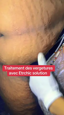 A post by @etrechisansvergeture on TikTok