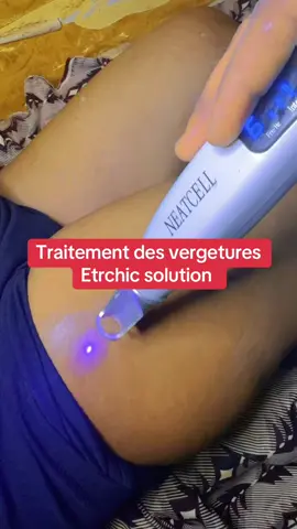 A post by @etrechisansvergeture on TikTok