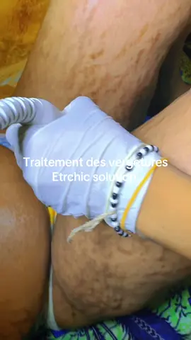 A post by @etrechisansvergeture on TikTok