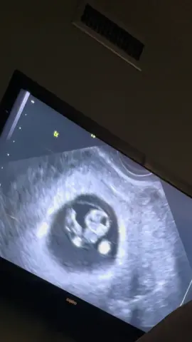 A post by @austinnnnw on TikTok caption: I cannot believe My baby boy is a 1 year old 🥺😭 Jaxon you’re the light of my life. Your smile is so pure and precious. Your eyes glow so bright and beautifully. Your touch is so soft and comforting. Your presence is everything I’ve always wanted. Words cannot explain how much i love you handsome. You’re so smart, funny, beautiful, loving and playful. I’m so blessed that i got picked to be your dada. You’ve brought me so much joy and love and pure happiness and I’m so thankful for you. I love you so so much and i just wanna say Happy 1st Birthday baby boy ❤️ @oliviaawhaley #fyp #1yearold #babyboy 