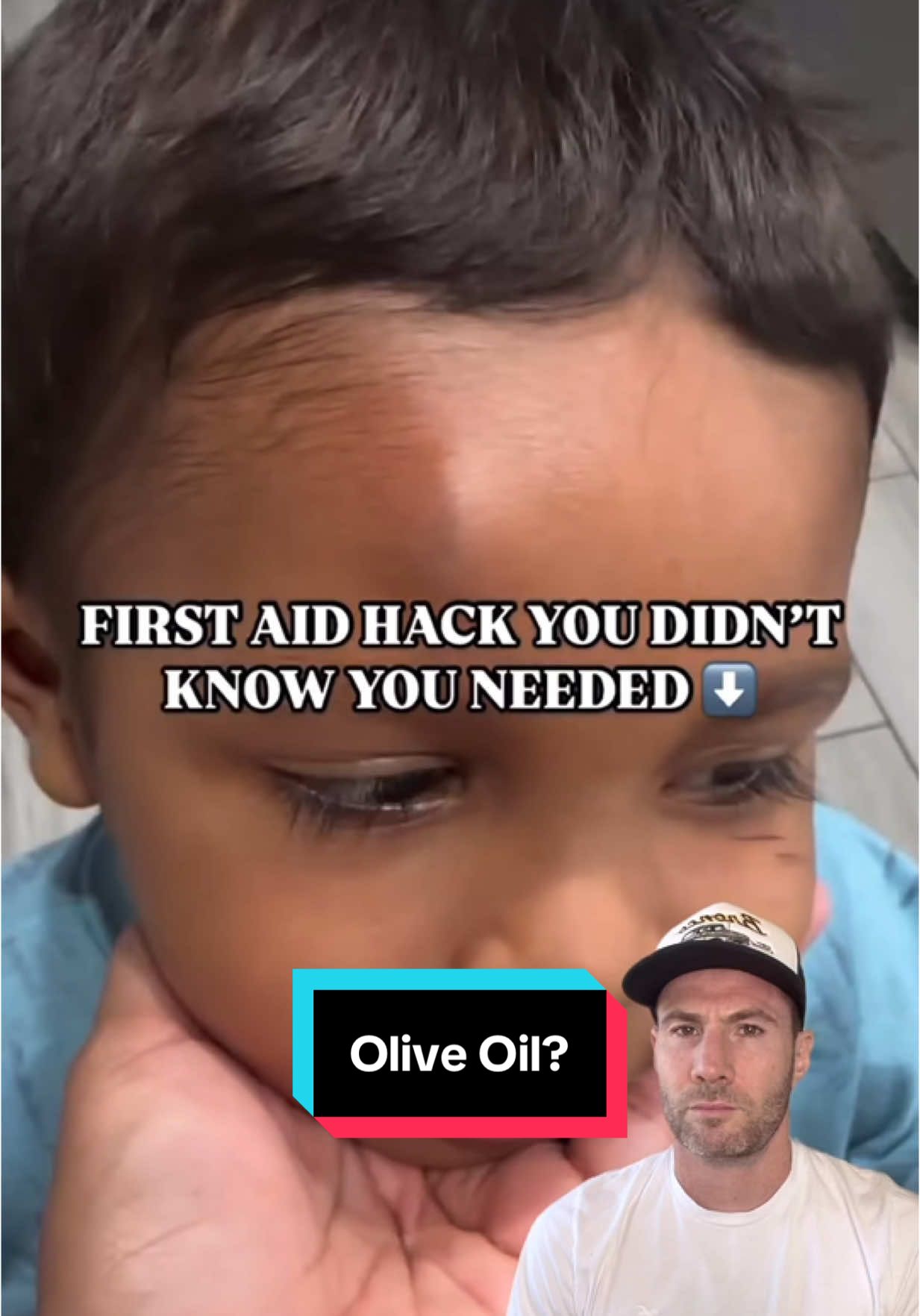A post by @drjoe_md on TikTok caption: Ever heard of using olive oil to make a forehead bump disappear fast? Unfortunately it’s not the oil doing the magic. What you’re seeing is the body naturally reabsorbing fluid or gravity shifting the swelling. The oil just gets credit for what time and biology already started. 🎥via IG @_miaxb #parentingtips #healthhacks #homeremedy #doctor 