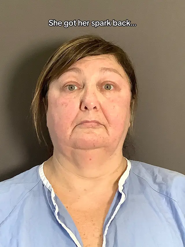 A post by @albertplasticsurgery on TikTok caption: This is why I’m such a strong advocate of face + neck lift combination procedures— one without the other is like ironing a shirt and leaving the sleeves 👀 Here’s a simple breakdown… ▶ Snatched jawline & tighter neck— removed excess fat & skin ▶ Lifted jowls & redefined lower face ▶ Smoothened, firmer skin ▶ Improved facial symmetry  We understand that going under the knife can be a taxing emotional process, which is why we’re here for you every step of the way— no matter how much time has passed! Our personable and dedicated staff will always be here for you! 🩵 Ready to turn back time on your face? Consult with us for free today! 📞 (212)-203-8623 💻 www.albertplasticsurgery.com 📍 950 Park Avenue, New York, NY  #necklift #facelift #smasfacelift  #deepplanefacelift #rhytidectomy  #PlasticSurgery #plasticsurgeon #AntiAging #antiwrinkle #beauty #aesthetics #lift #NYC #nycplasticsurgery #parkavenue #transformation #nycplasticsurgeon #nycplasticsurgery #testimonial #beforeandafter #MaestriDelPov 