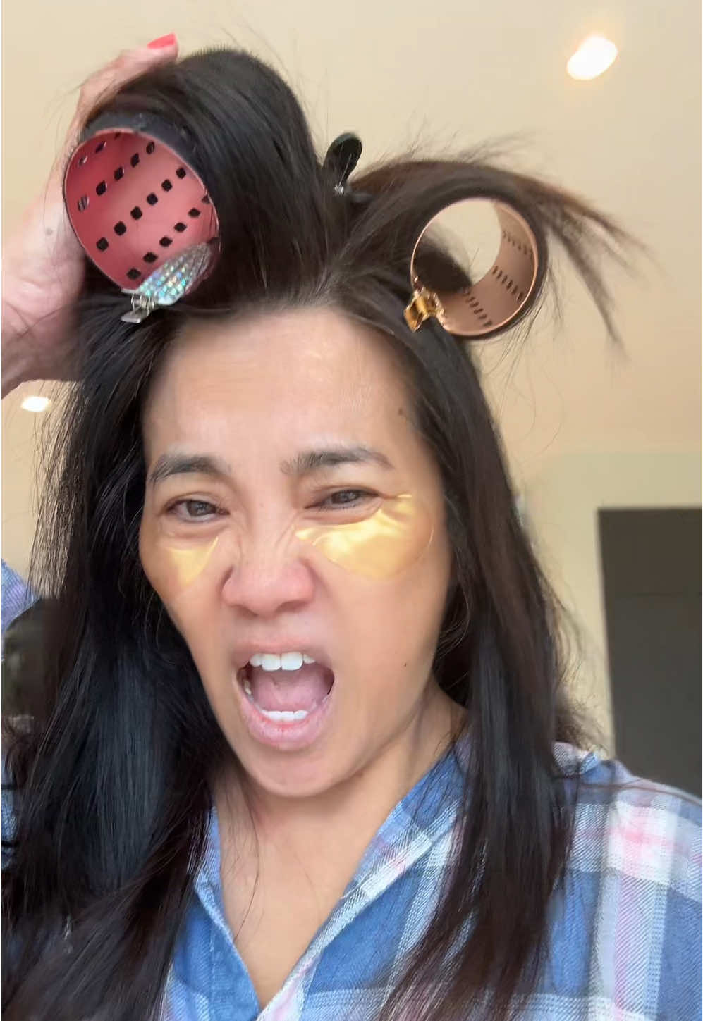 A post by @drpimplepopper on TikTok caption: Look at my HAIR. So FAB after @Bradley Leake @kelsey @ANGIE get to me! 😂😊#drpimplepopper 