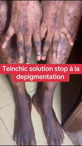 A post by @teintchicsansvergetures on TikTok