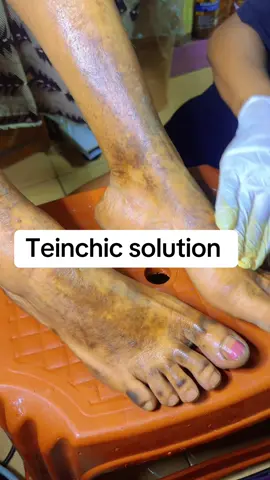 A post by @teintchicsansvergetures on TikTok