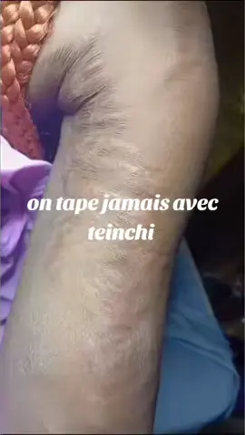 A post by @teintchicsansvergetures on TikTok caption: #cejour-là 