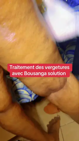 A post by @teintchicsansvergetures on TikTok