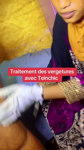 A post by @teintchicsansvergetures on TikTok