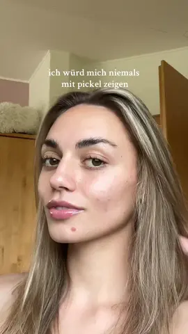 A post by @tinaneumann on TikTok caption: Alles damit ihr euch nicht alleine mit solchen „Hautproblemen“ fühlt! Ly!💗