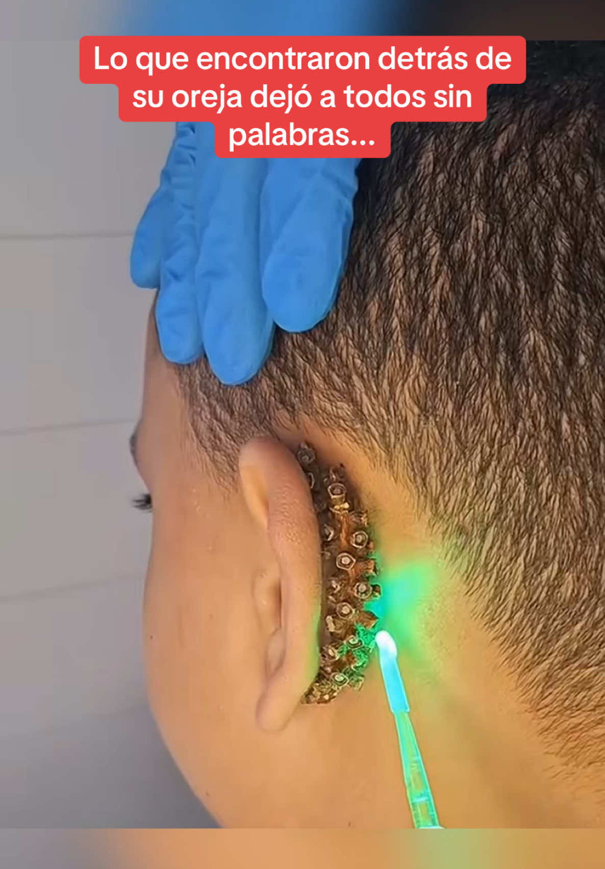 A post by @historia_real_estr on TikTok caption: John, un niño de solo 5 años, sufría de un dolor extraño detrás de su oreja que nadie podía explicar. Pero cuando los médicos decidieron intervenir, descubrieron algo tan impactante que incluso el cirujano quedó paralizado. ¿Te atreves a saber qué era? Mira hasta el final y comenta “Oreja” para la parte 2. #sorprendente #historiasimpactantes #Sorpresa #misterio 