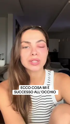 A post by @accorciabro on TikTok