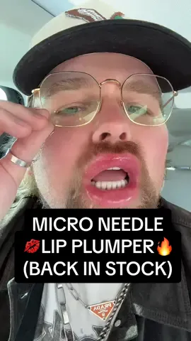 A post by @thisdadtiktoks on TikTok caption: BACK IN STOCK.. GET READY!  😏👄#drmelaxin #drmelaxinlipplumper #backinstock #restocked #maxilip #part2 #lipplumper #plumplips #lipfiller #lippies #lipprducts #drmelaxin #biospicule #lipshotmaxi #hardtouch #koreanlip #koreanlips #koreanskincare #korea #painisbeauty #ttsstarcreator #TikTokShop #tiktokshopfinds #giftidea #giftsforher #giftsforhim #tiktokshopmademebuyit #TikTokShopCreatorPicks #tiktokmademebuyit #fyp #flashsale #tiktokshopdeals #TTSLevelUp #springglowupchallenge #springglowupboost #springglowup #springglowup2025 #springglowupsale #virallipplumper #virallipplumperguy #whatlipplumperwentviral #guyreviewslipplumper #restocksale #tiktokshoprestock #cocomintbeauty #spicule #spicules #lipshot @Dr.Melaxin Global 