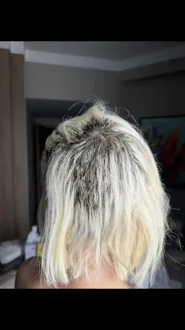 A post by @deejaysoda on TikTok caption: Please beware when you bleach your hair!  You probably shocked by the photos.  I wanted to show you a pretty side of me again, so after my tour, I came back to Korea and tried to surprise you all by going blonde Soda again after 3 years. I went to a hair salon where I usually go to bleach my hair, but they left the bleach on for way too long. It went horribly wrong. but something went really wrong. The bleach melted my hair from the roots, and in the end, I had to shave the whole back and sides of my head. Many people who saw me at events and shows were very shocked. I was also very surprised and sad. My hair kept falling out in big handfuls every day. I was so upset that I couldn’t sleep for 2 weeks and cried almost every day. It’s really hard for me to look in the mirror. When I see videos fans took of me, I feel even more heartbroken. And it’s not over yet… My hair is still falling out more. Most of it is only about 3mm long now, so I can’t even get hair extensions. It will take over 2 years for my hair to grow back. Now I try to cover the bald parts with the little hair I have left. It makes me feel very lost and very sad every day. After thinking a lot, I wanted to gently tell you about my condition just in case you see me and feel shocked. Don’t end up like me, bleaching really depends on the hairstylist’s skill, so make sure to do your research and get it done by a bleaching specialist!