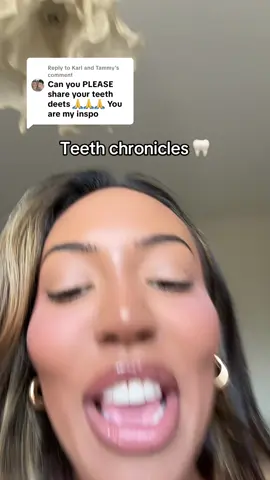 A post by @ash_holme on TikTok caption: Replying to @Karl and Tammy PUT THE VENEER BOOKLET DOWN DIVAS