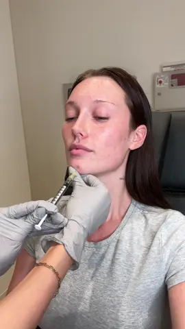 A post by @meredithduxbury on TikTok caption: injecting my pimple with my queen @Dr. Connie Yang @Paul Jarrod Frank MD 