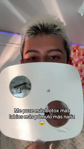 A post by @jonasymikeoficial on TikTok caption: Ya me puse más labios,pómulo,nariz 😱 tienen que probar @Taptap Send México #fyp #foryou #foryoupage #fypシ #parati #filler #fillers #botox #hyaluronicacid #love #fashion #style #moda #newlook #viral #viralvideo #viraltiktok 