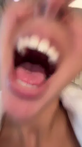 A post by @rosee_20 on TikTok caption: bark like you want ittttt 😏🐕 #fy 