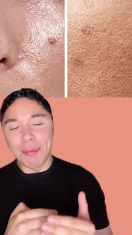 A post by @carlosantoniocerv on TikTok caption: @Dr.Leo-USA  #deepcleanse #oilcontrol #fyp #skincare  #effortlessbeauty #TikTokShopSummerTurnup #drleo #deepcleanse   #springtok  #SkinCare #parati #SkinCare #skin #cuidatupiel #pielsanaybonita #pielsana #pielsanaysaludable #cuidadodelapiel #productoseconomicos #skincareproducts #dupes #dupe #cuidatelapiel #perfectskin #pielperfecta #versioneconomica #lomismoperomasbarato  #lomismoperomaseconomico #carlosantoniocerv #lovelanguage