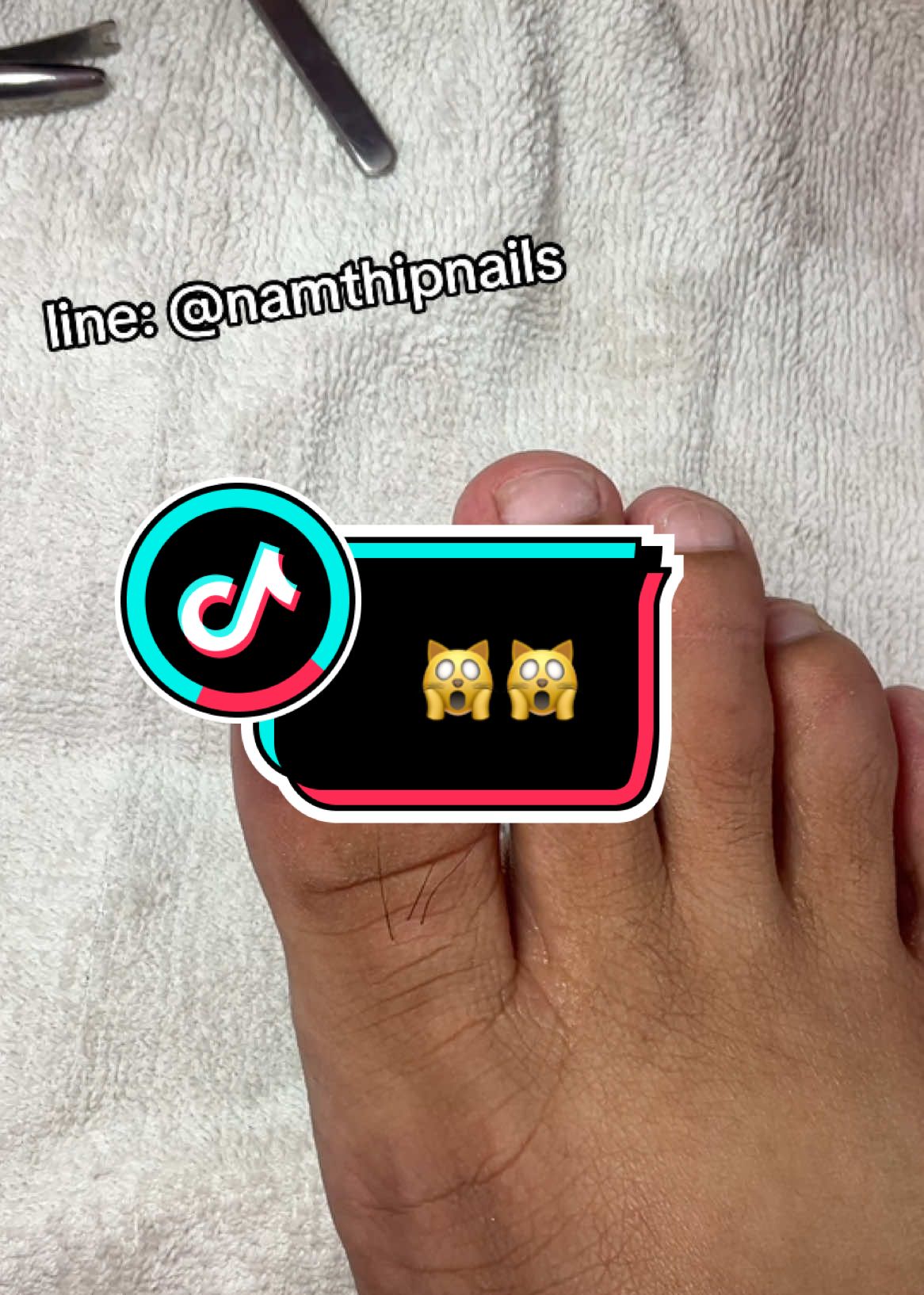 A post by @namthipnails5 on TikTok caption: 💓 #namthipnails #ตัดเล็บขบ #ตัดหนัง #ทำเล็บ #ร้านตัดเล็บขบ #ร้านตัดเล็บขบราม2 #ตัดเล็บ #เล็บขบ  #เล็บเชื้อรา Fb : namthipnails  Line : @namthipnails  นัมเบอร์วัน8 ตลาดม.ราม2  กทม  Map: namthipnails  https://goo.gl/maps/JmwpCKLfKwmhKGK96  ร้านเปิดทุกวัน เวลา12.00น-22.00น.